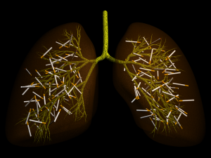 Smoker's lung